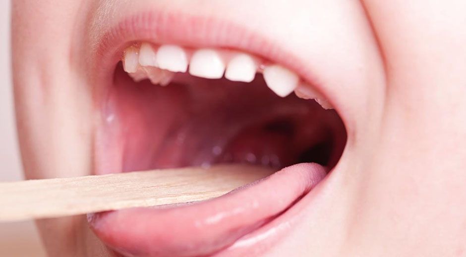 Celulitis por estreptococo pyogenes