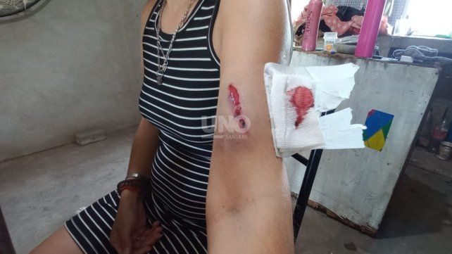 Atacaron a Melisa Soperez, la hermana del intendente de Rincón.