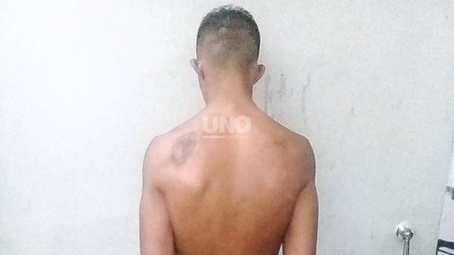A los pocos minutos que apuñaló al chico de 18 años en las calles del barrio Brigadier López, el joven fue detenido por la policía.