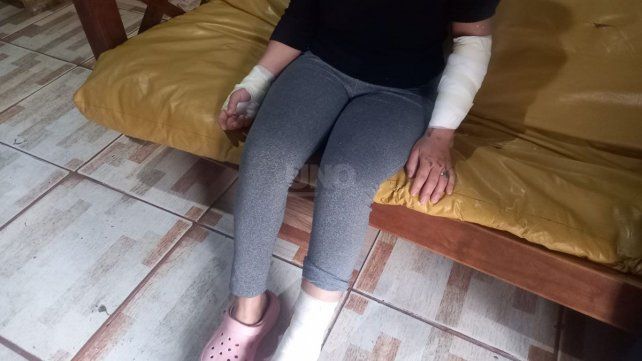 Keila, la mujer que fue atropellada el pasado viernes por un hombre hoy detenido e imputado por lesiones graves que huyo tras el siniestro.