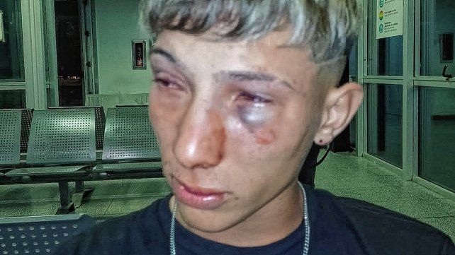 Alejandro fue agredido en un boliche de la ruta 168.