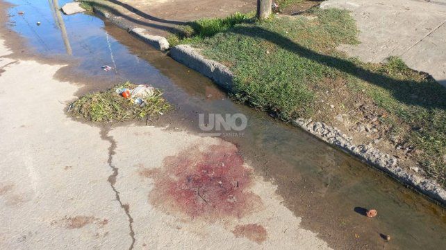El hecho sucedió en la noche del lunes en las calles de barrio Santa Rosa de Lima. El adolescente atropellado por un patrullero fue dado de alta El hecho sucedió en la noche del lunes en las calles de barrio Santa Rosa de Lima. El adolescente atropellado por un patrullero fue dado de alta