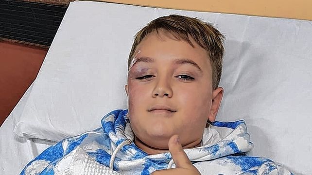 Atropellaron a un niño en la ciclovía de Vélez Sarsfield y Alem y el conductor se fugó: 