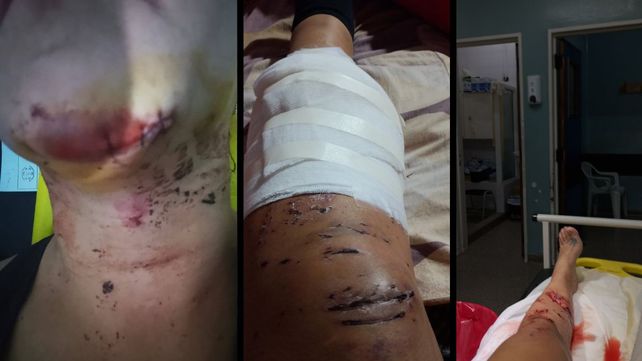 Otro caso de choque y fuga en Santa Fe: denuncian que un auto en contramano los embisti&oacute; y dej&oacute; abandonados. &nbsp;