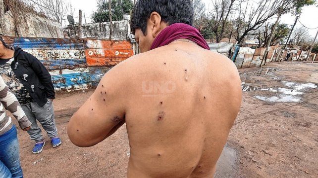 Cornelio la relató al Móvil de UNO lo que ocurrió durante el ataque a tiros que sufrieron en el barrio