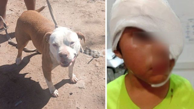La niña de 8 años sufrió la mordedura en su rostro cuando jugaba con el animal en la casa de una amiguita La niña de 8 años sufrió la mordedura en su rostro cuando jugaba con el animal en la casa de una amiguita