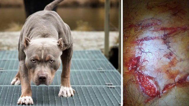 La herida que el perro le provocó al agente de policía.